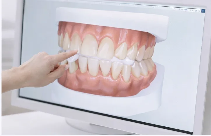 신경치료가 필요한 주요 원인