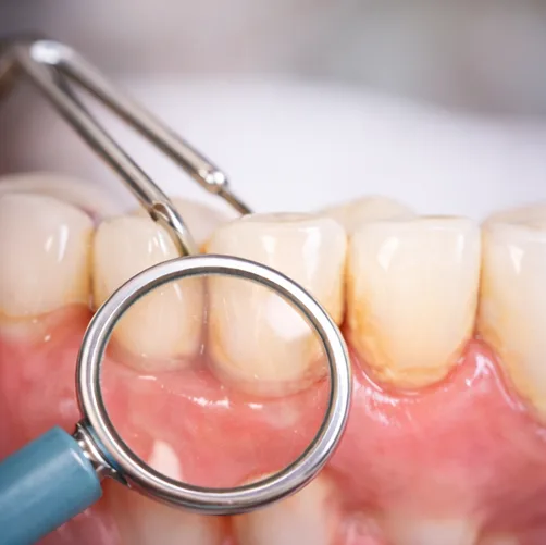 잘못된 칫솔질 습관