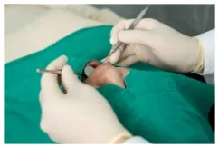 4. 임플란트는 '시술 후의 시간'이 더 중요합니다.