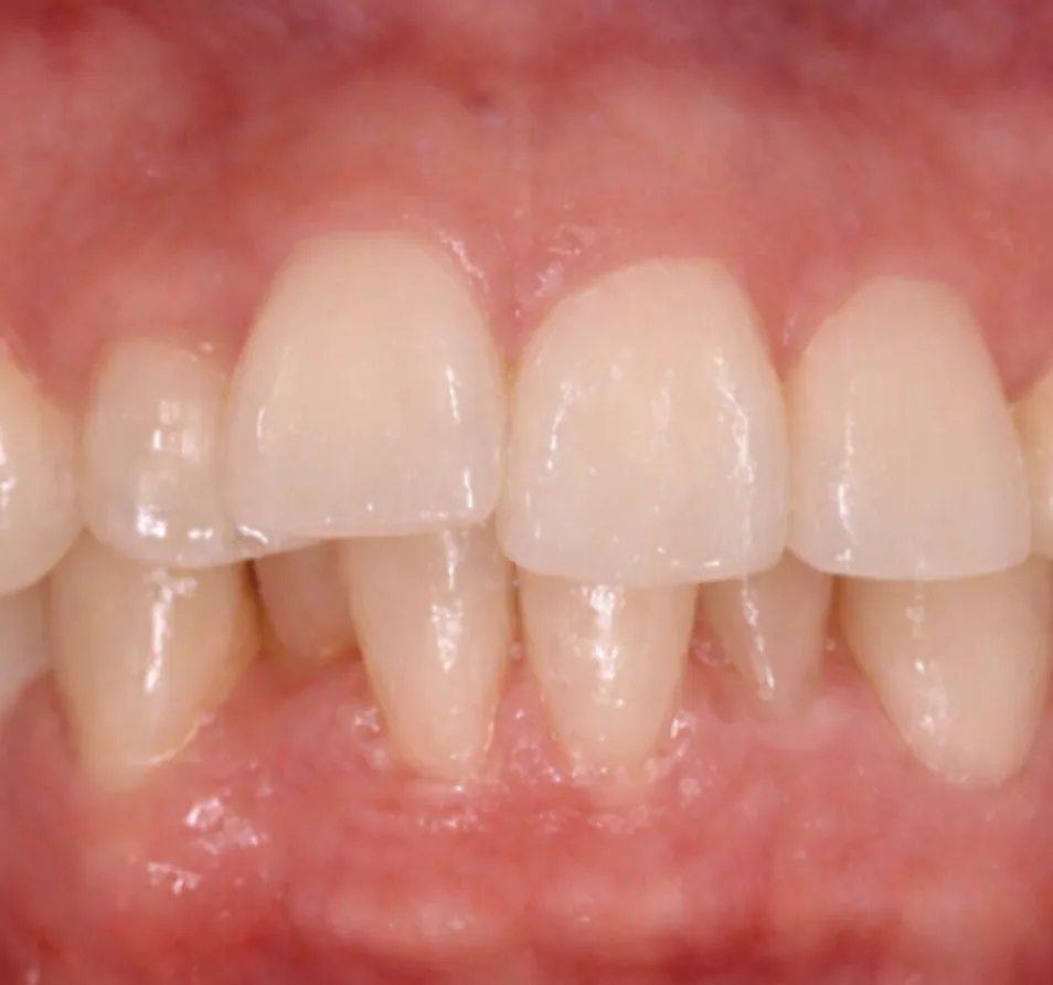 교정 사례 이미지 1