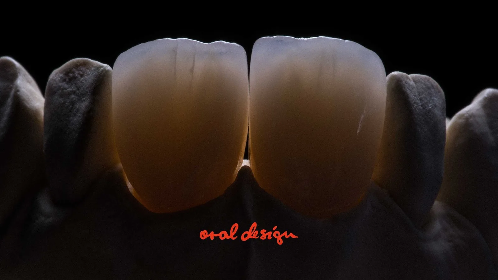 라미네이트 전후 비교