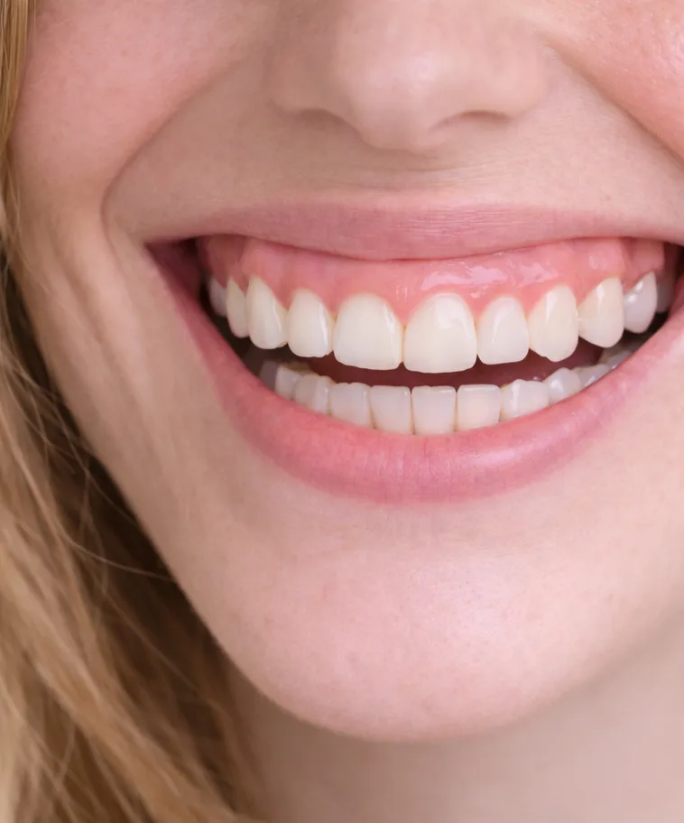 거미스마일 이미지