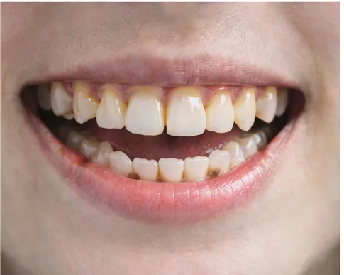 대표 증상 이미지 4