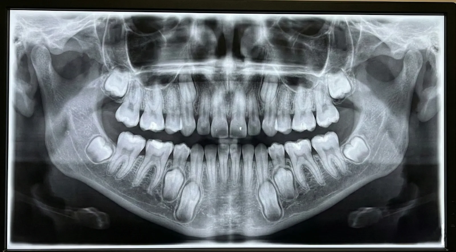 소아검진 과정 이미지 1