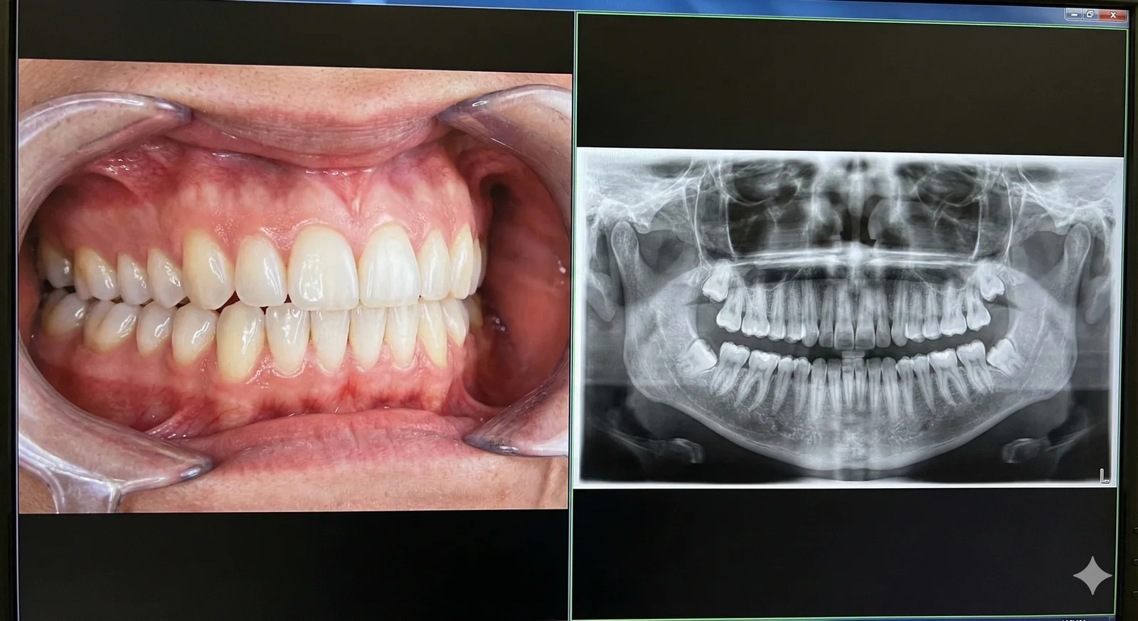 소아검진 과정 이미지 3